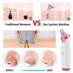 Vacuum Blackhead Remover Pore Cleaner Electric Nose Face Deep Cleaning Skin Care Machine Aspirator Point Skin Care Tool Beauty